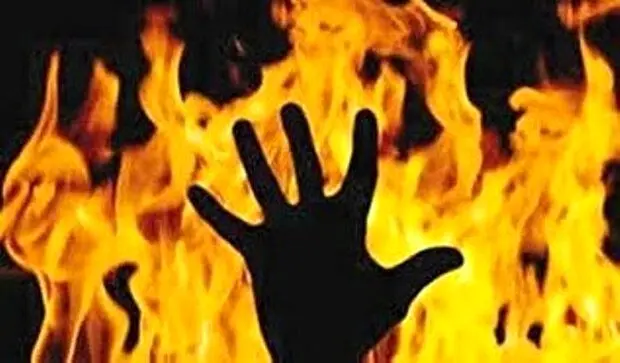 سوختگي،دامغان،ساري،كارگر