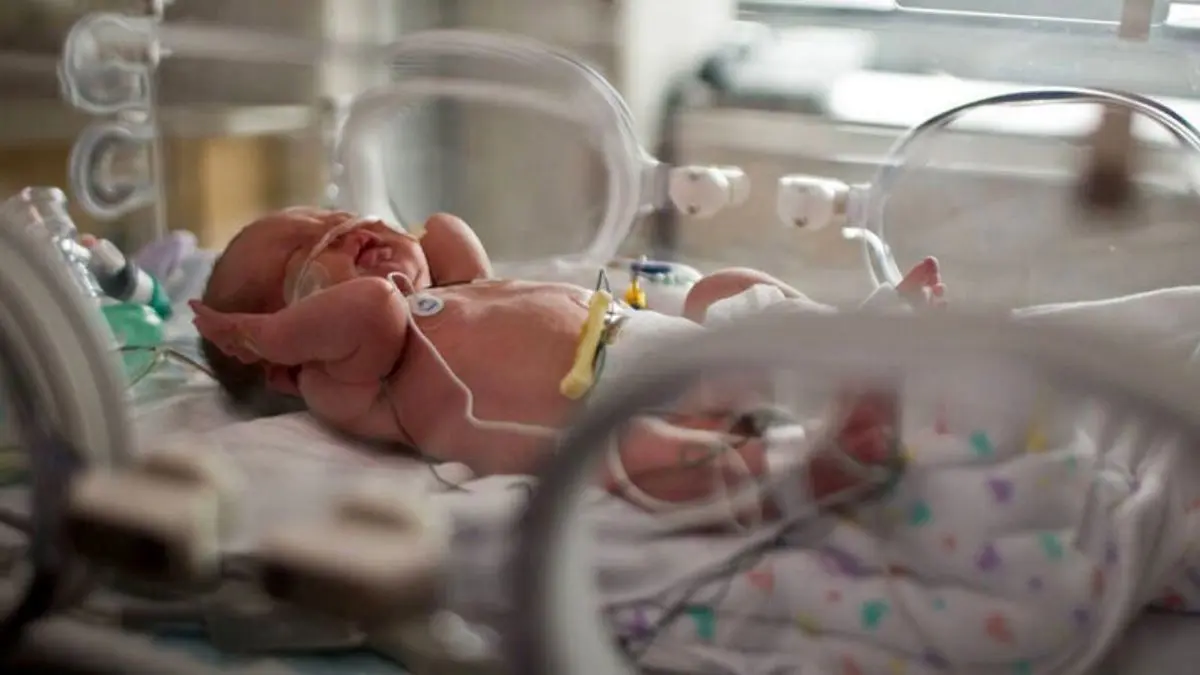 نوزاد مبتلا به ویروس کرونا در انگلیس متولد شد