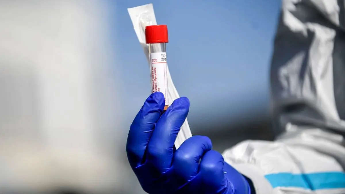 آزمایشگاه‌های انگلیس فاقد توان کافی برای آزمایش ویروس کرونا هستند