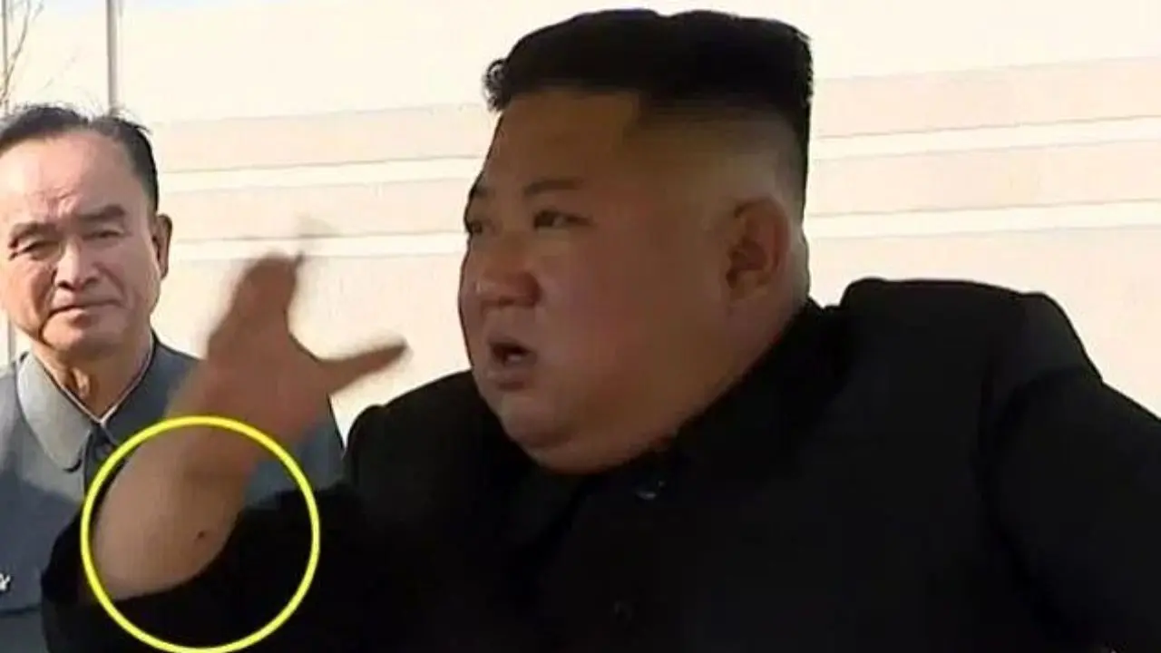 جای سوزن بر مچ «کیم جونگ اون»/ رهبر کره شمالی عمل جراحی انجام داده است؟