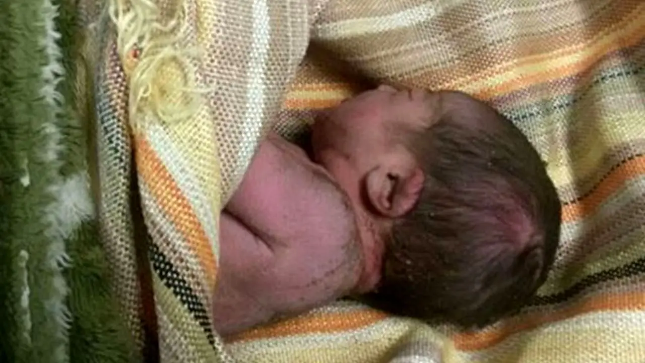 نوزاد رها شده در سطل زباله نجات پیدا کرد