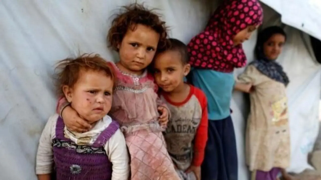 سوء تغذیه 2 میلیون و 400 هزار کودک یمنی