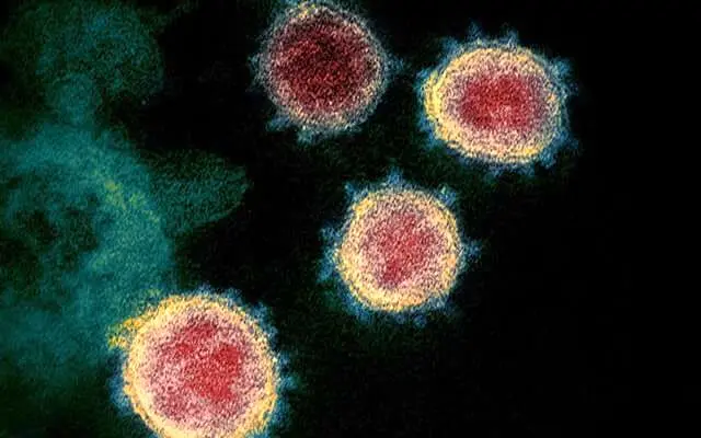 روند ویروس کرونا در 7 استان کشور صعودی است