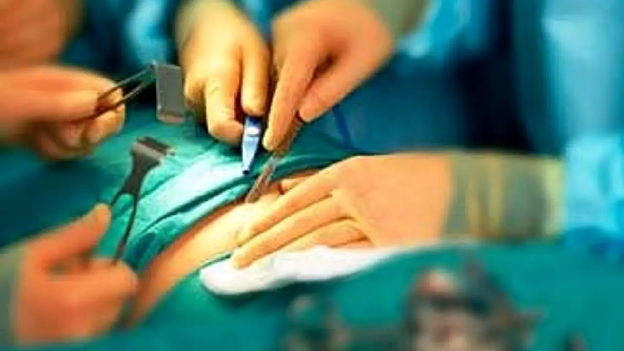 سالانه 30 هزار جراحی زیبایی در کشور انجام می‌شود
