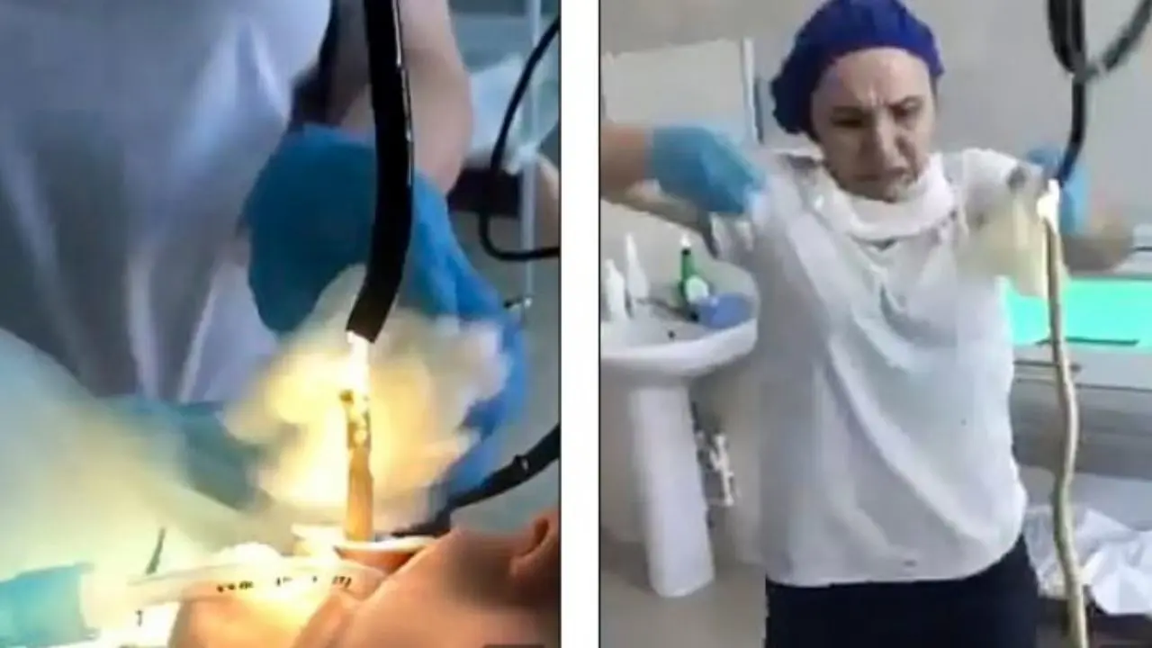 دور دنیا | پزشکان از معده یک زن روس مار خارج کردند + ویدئو