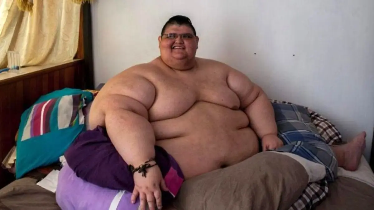 ویروس کرونا| چاق‌ترین مرد جهان کرونا را شکست داد