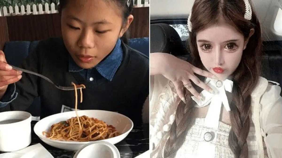 دور دنیا| دختر نوجوان چینی 100 عمل جراحی برای زیبایی انجام داد+ عکس