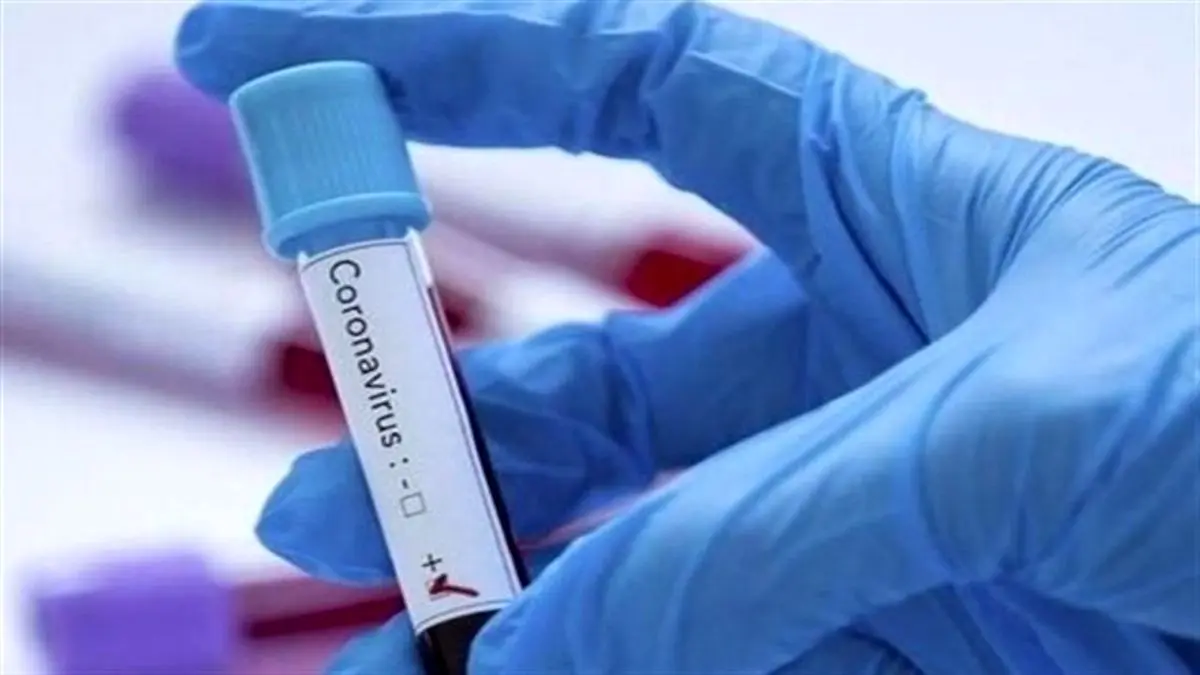 12هزار تست PCR کرونا در مبادی مرزی انجام شد