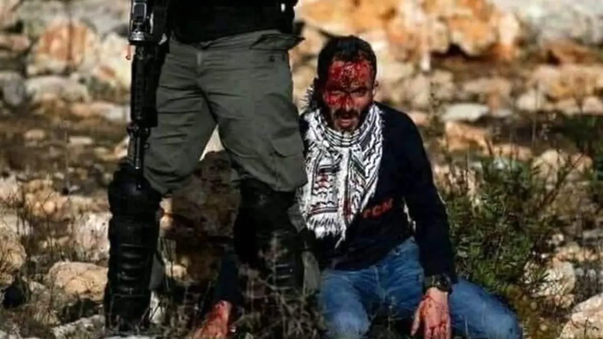 یک فلسطینی زخمی در رام‌الله به شهادت رسید