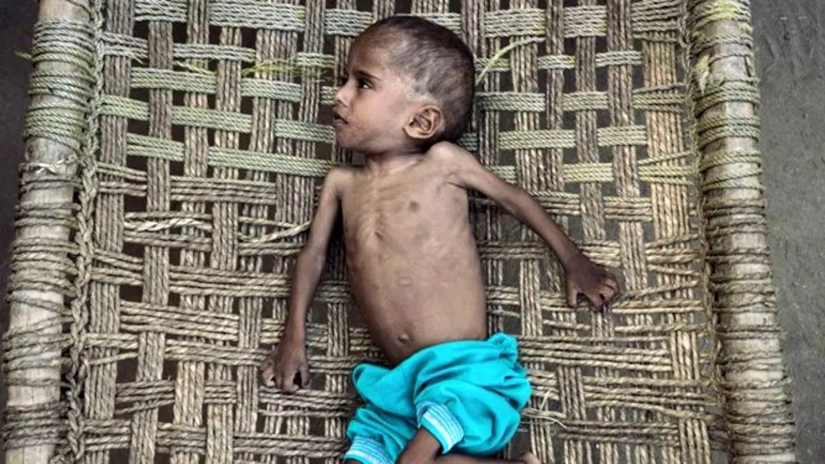 یمن؛ فوت سالیانه 8000 زن/ هر پنج دقیقه یک کودک می‌میرد