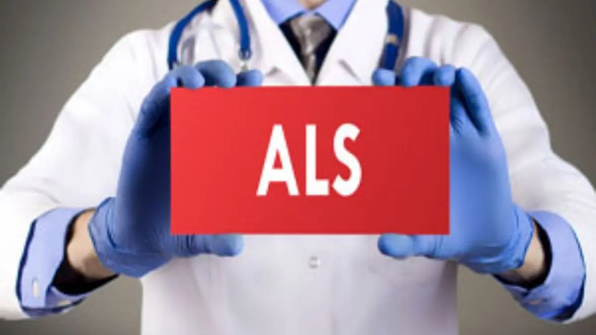 هزینه درمان ماهیانه بیماران ALS 20 میلیون تومان است / بیماران ALS از زمان شروع بیماری نیاز به ای سی یو خانگی دارند