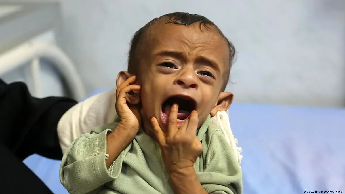 روایت بازیگر آمریکایی از جنایت جاری در یمن؛ ما مرده به دنیا می‌آییم