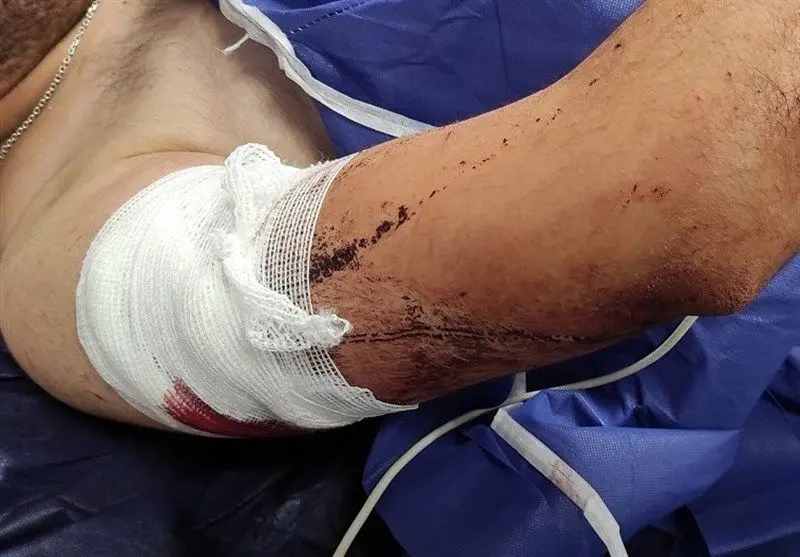 خفتگیری خشن از دانشجوی علوم پزشکی گلستان + وضعیت جسمی مصدوم