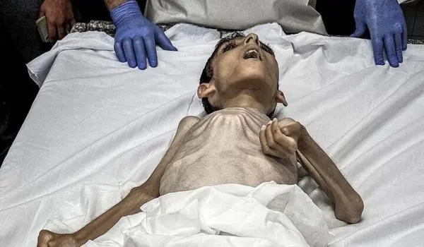 سازمان ملل: کودکان غزه از گرسنگی جان می‌دهند