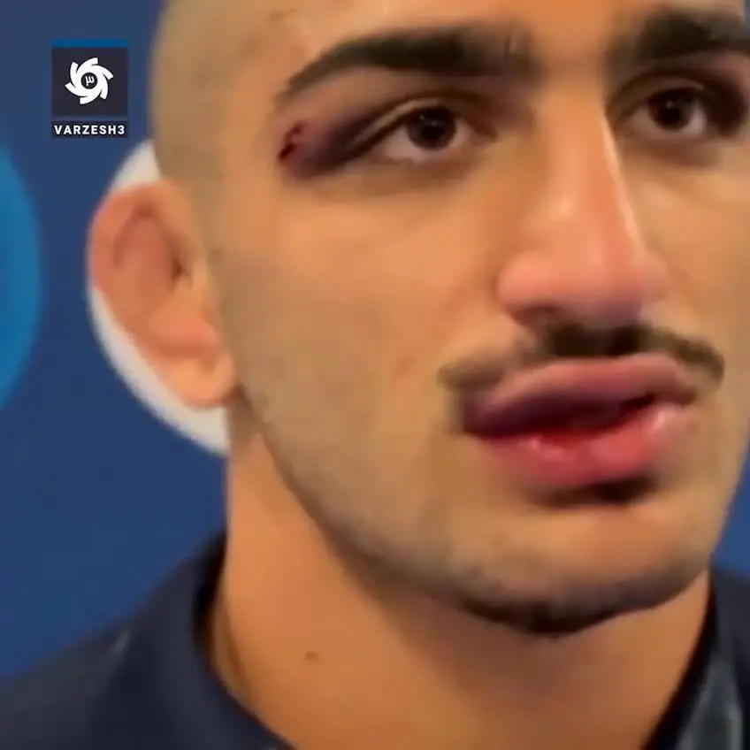 ببینید| سهرابی: برای دل پدر و برادر بیمارم جنگیدم