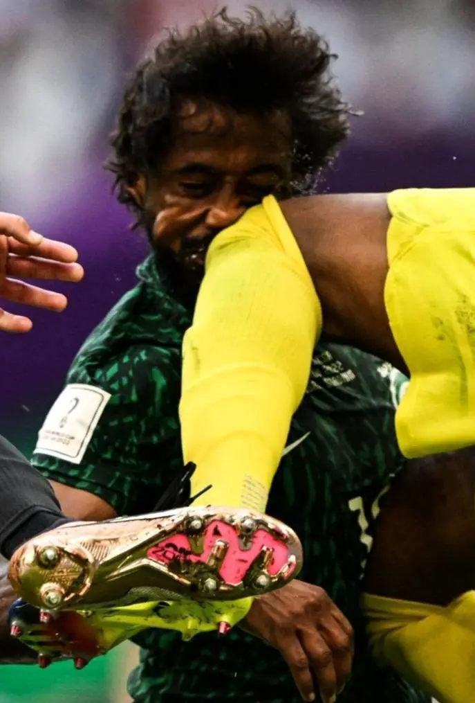 مدافع عربستان دومین «صورت زخمی» جام جهانی بعد از بیرانوند