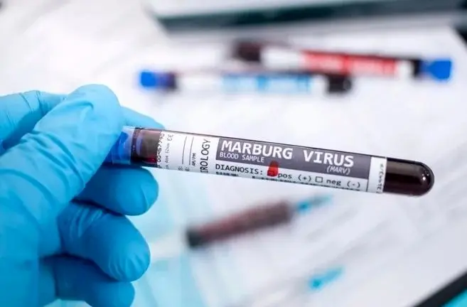 بیماری ویروسی «ماربورگ» هنوز تهدیدی برای ایران و کشورهای منطقه نیست/ویروس «ماربورگ» واکسن ندارد