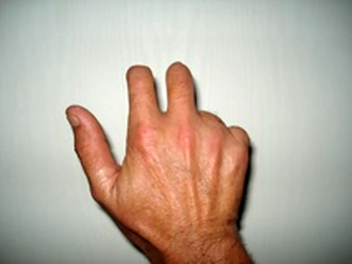 اجرای حکم قطع انگشتان دست دو سارق در قم