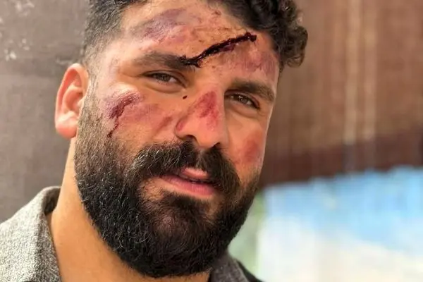 سقوط میلاد کرمی بلاگر معروف اینستاگرامی در کوهستان+ فیلم