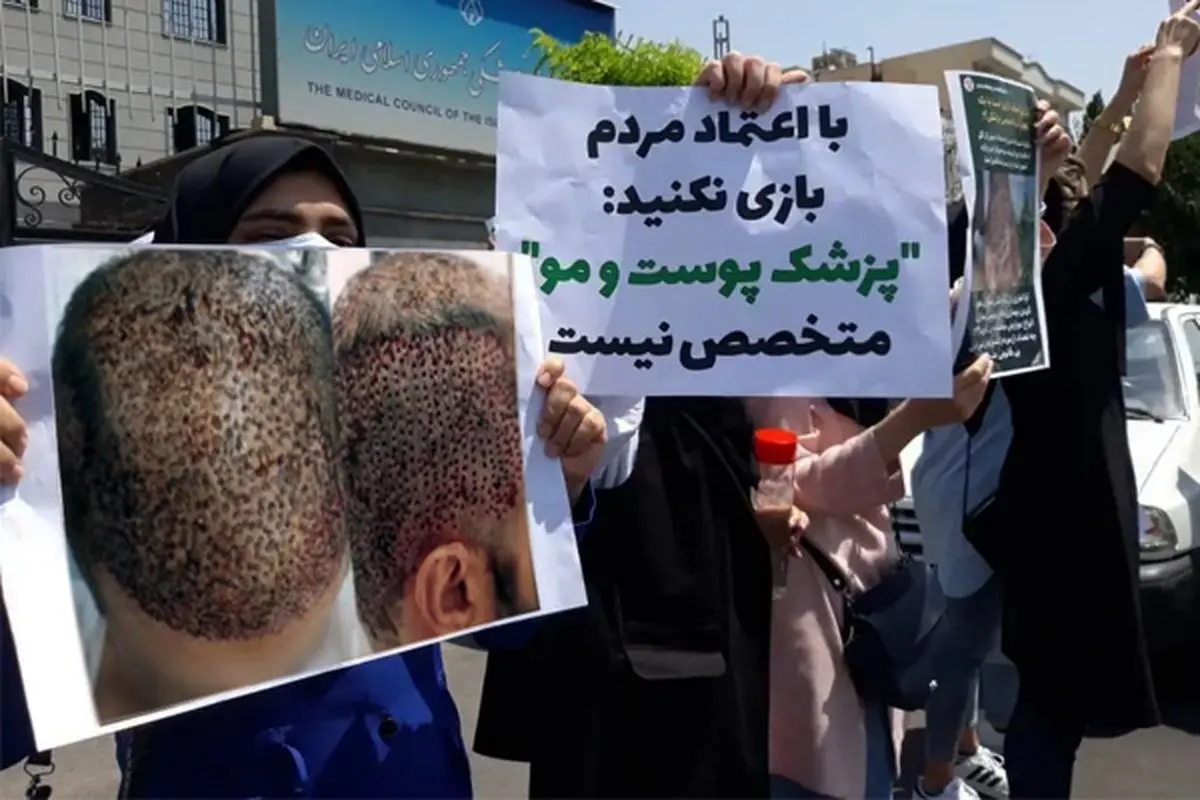 شکایت‌های رو به افزایش از نتایج کاشت مو ناموفق؛ زیر ذره‌بین نهادهای ناظر