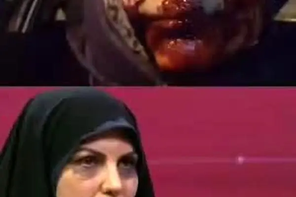 ببینید| شاهد عینی از ساچمه‌زنی به صورت: می‌خواست مرا بکشد