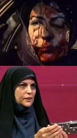 ببینید| شاهد عینی از ساچمه‌زنی به صورت: می‌خواست مرا بکشد