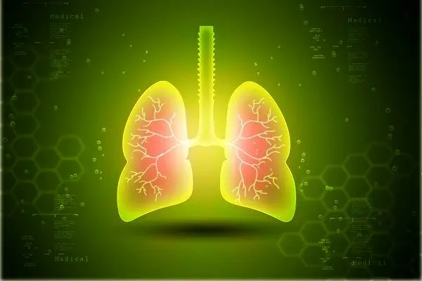 آسم،بيماري،آلرژي،افزايش،جولا،استنشاقي،ابتلاي،غذايي،بهبود