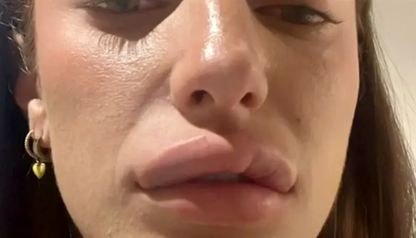 مشکلات عمل‌های زیبایی باز هم خبرساز شد