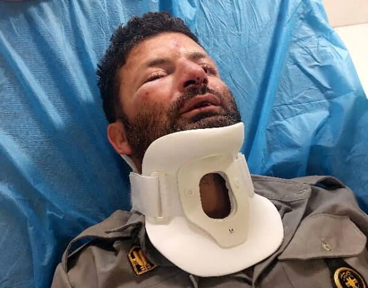 دومین حمله به حافظان طبیعت در شمیرانات؛‌ این بار ضرب و شتم یک محیط‌‌بان